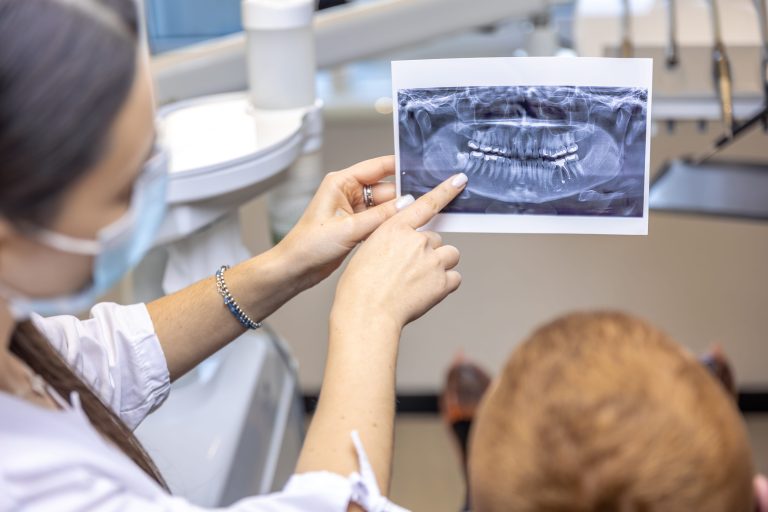 Dentist discussing MARPE treatment using a panoramic X-ray with a seated patient.